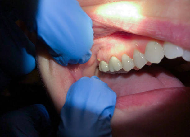 Best Emergency Dental Surgery in Hoopers Creek, NC