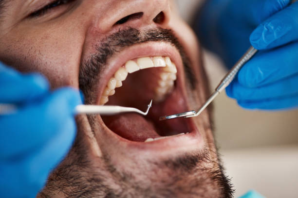 Best Same-Day Emergency Dentist in Hoopers Creek, NC